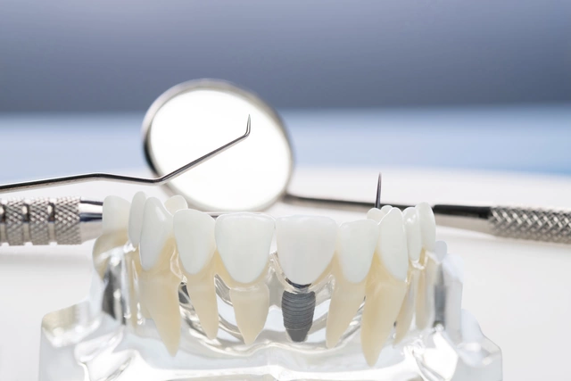 Acyclovir in Dentistry: Applications and Benefits