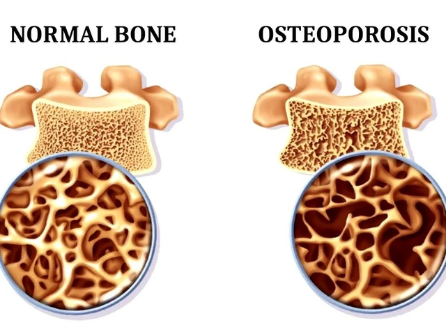 The impact of amiloride on bone health and osteoporosis